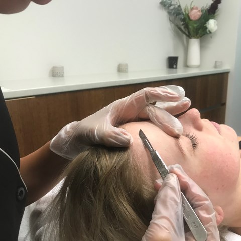 Dermaplaning Post Treatment Care